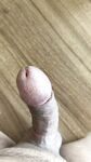 Penis: 2 Nude Pics