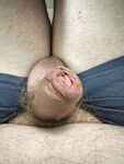 My foreskin penis: 2 Nude Pics