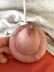 Foreskin extreme torture: 5 Nude Pics