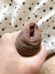 Pumped foreskin porn: 4 Nude Pics