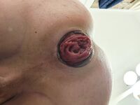 My gaping hole: 20 Nude Pics