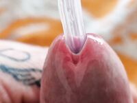 Urethra play and syringe close up photo's : 28 Nude Pics