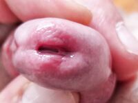 Urethra play and syringe close up photo's : 28 Nude Pics