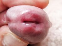 Urethra play and syringe close up photo's : 28 Nude Pics