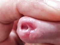Urethra play and syringe close up photo's : 28 Nude Pics