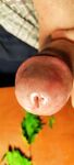 After nettle: 7 Nude Pics