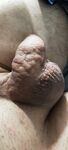 After nettle: 7 Nude Pics