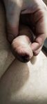 After nettle: 7 Nude Pics