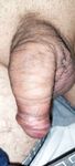 After nettle: 7 Nude Pics