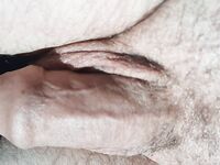 Pic's of penis : 37 Nude Pics