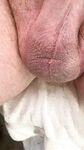 Compilation of uncut cock pics: 129 Nude Pics