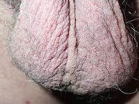 My penis up close: 20 Nude Pics