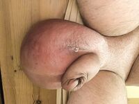 Glucose Infusion : 18 Nude Pics