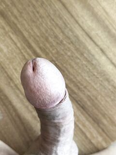 Penis: 2 Nude Pics