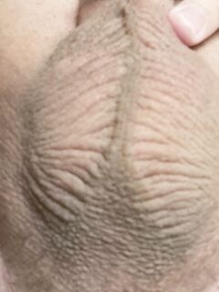 Eier: 4 Nude Pics