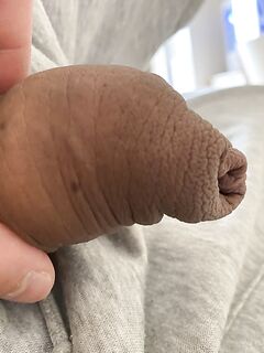 Very loose foreskin: 3 Nude Pics
