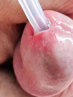 Urethra play and syringe close up photo's : 28 Nude Pics