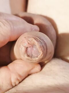 Pullerwichsi: 13 Nude Pics